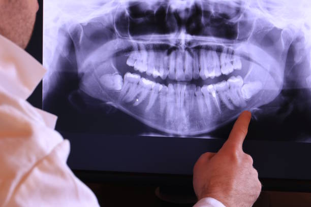 Best Emergency Tooth Extraction in Tuolumne City, CA