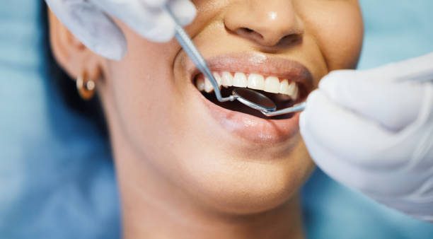 Best Emergency Wisdom Teeth Removal in Tuolumne City, CA