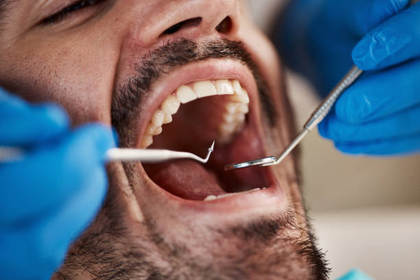 Best Emergency Treatment for Toothache in Tuolumne City, CA